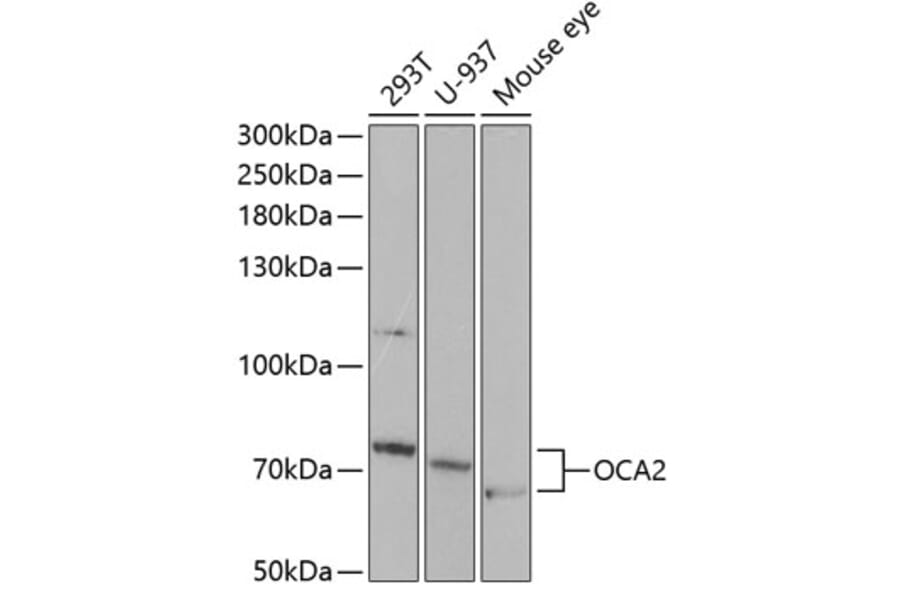 Western Blot - Anti-OCA2 Antibody (A11859) - Antibodies.com