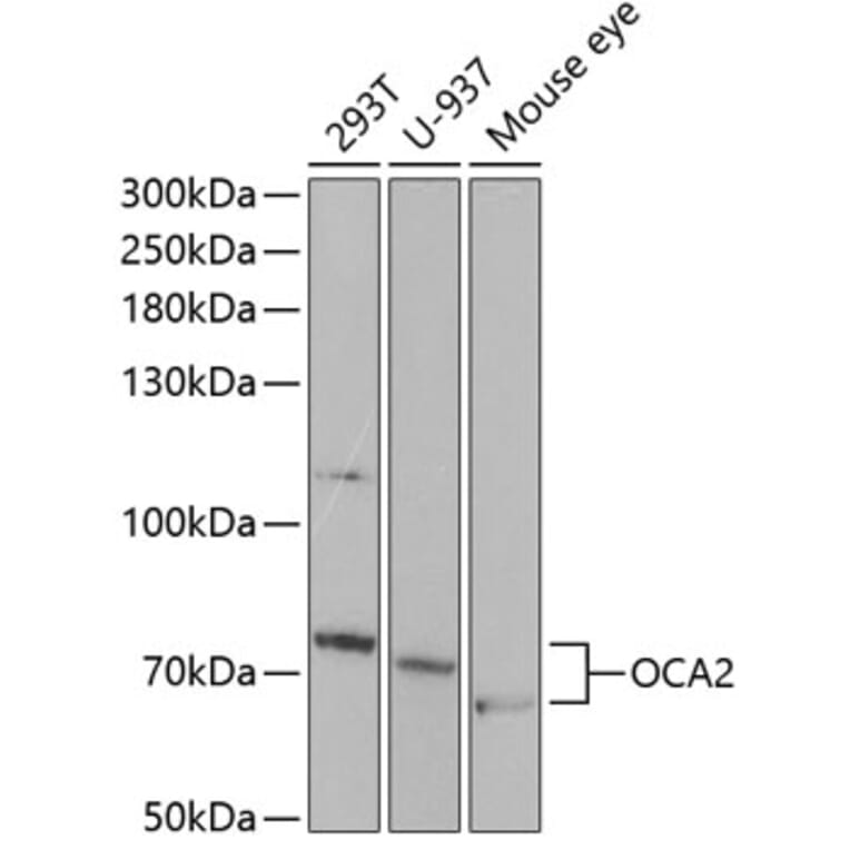 Western Blot - Anti-OCA2 Antibody (A11859) - Antibodies.com