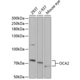 Western Blot - Anti-OCA2 Antibody (A11859) - Antibodies.com