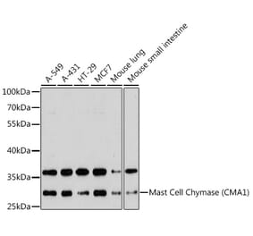Western Blot - Anti-Mast Cell Chymase Antibody (A11860) - Antibodies.com