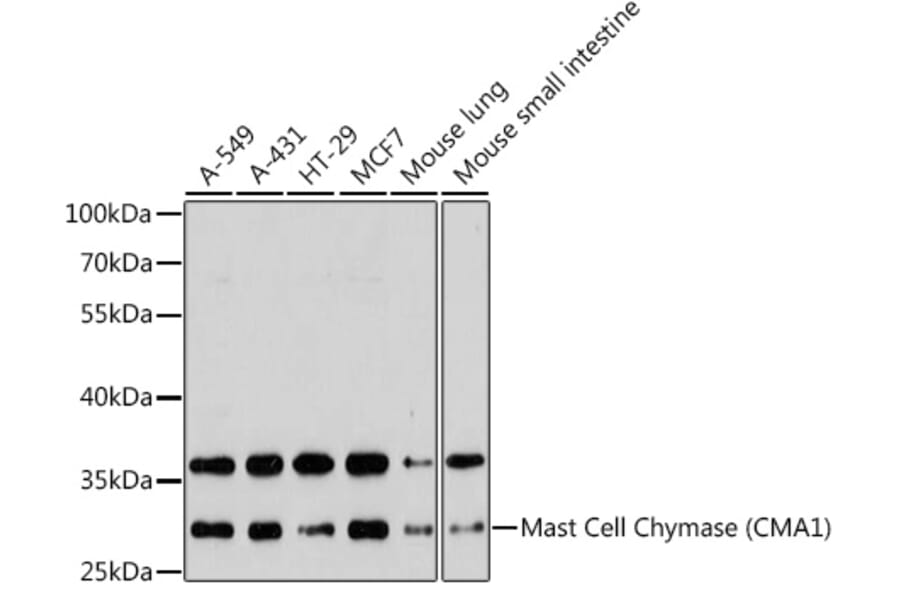 Western Blot - Anti-Mast Cell Chymase Antibody (A11860) - Antibodies.com
