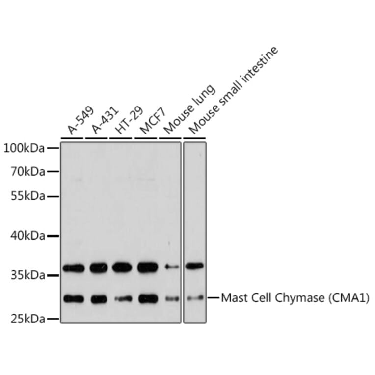 Western Blot - Anti-Mast Cell Chymase Antibody (A11860) - Antibodies.com