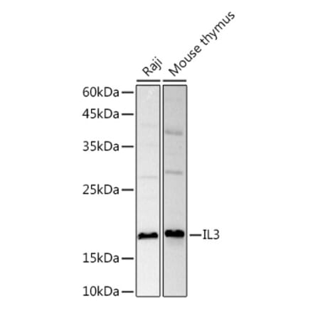 Western Blot - Anti-IL-3 Antibody (A11861) - Antibodies.com