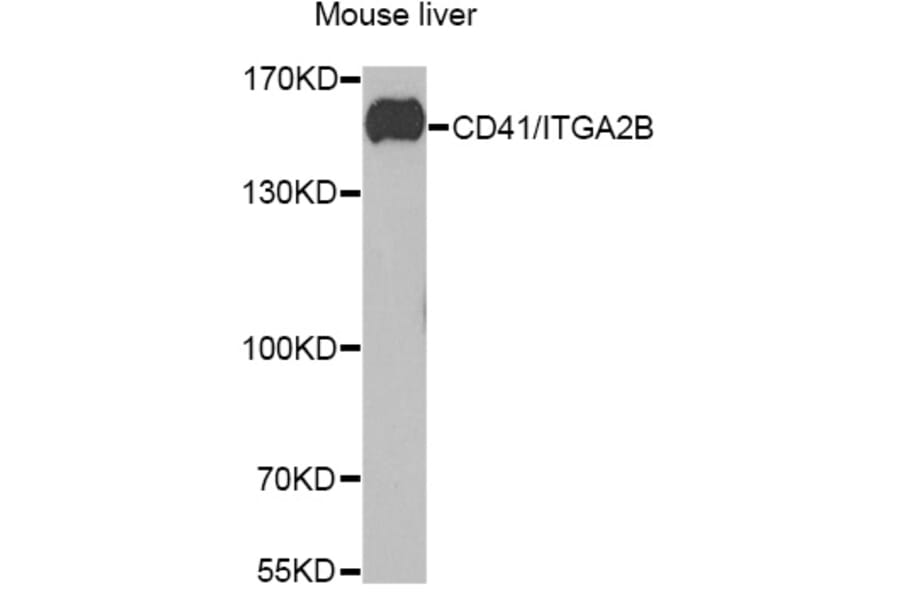 Western Blot - Anti-CD41 Antibody (A11862) - Antibodies.com