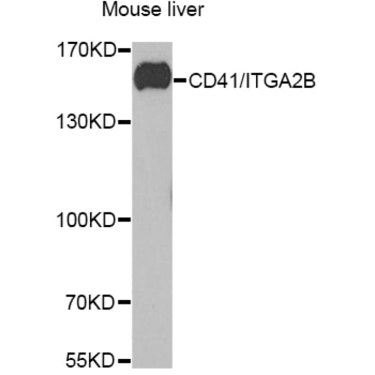 Western Blot - Anti-CD41 Antibody (A11862) - Antibodies.com