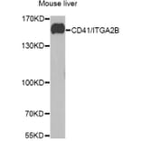 Western Blot - Anti-CD41 Antibody (A11862) - Antibodies.com
