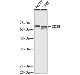 Western Blot - Anti-CD58 Antibody (A11863) - Antibodies.com