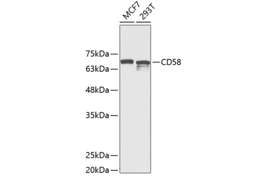 Western Blot - Anti-CD58 Antibody (A11863) - Antibodies.com