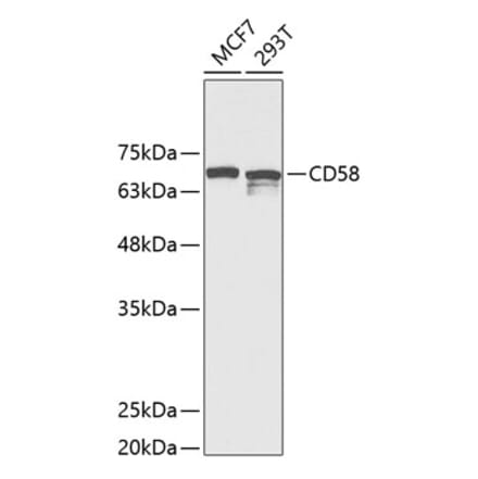 Western Blot - Anti-CD58 Antibody (A11863) - Antibodies.com