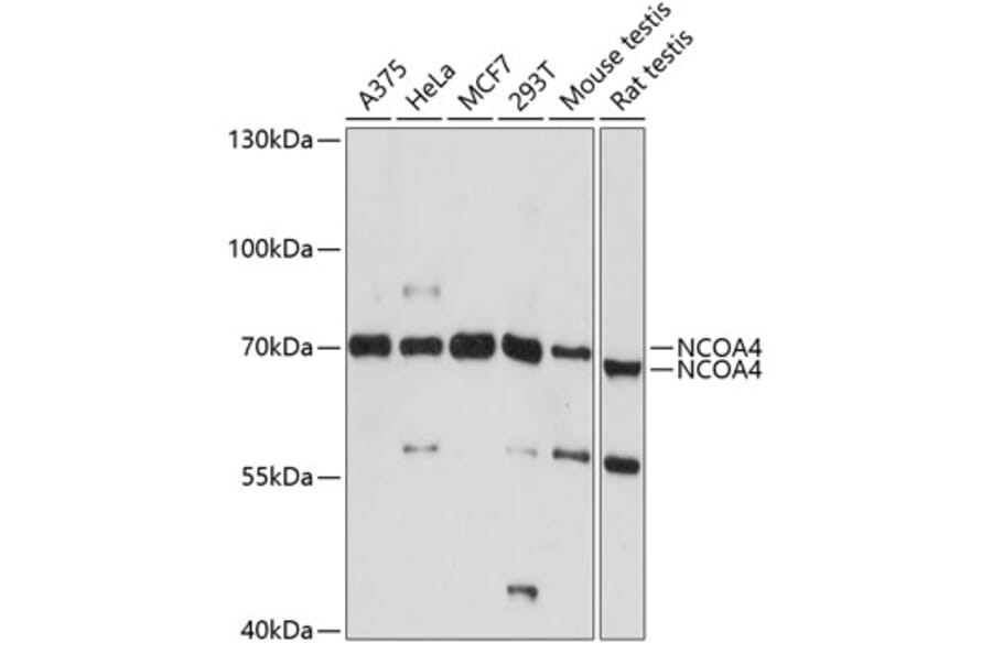 Western Blot - Anti-NCOA4 Antibody (A5695) - Antibodies.com