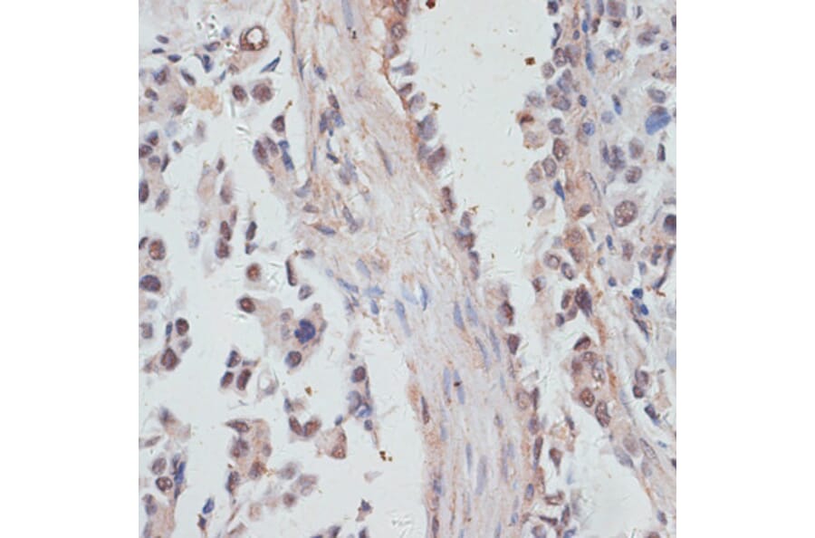 Immunohistochemistry - Anti-NCOA4 Antibody (A5695) - Antibodies.com