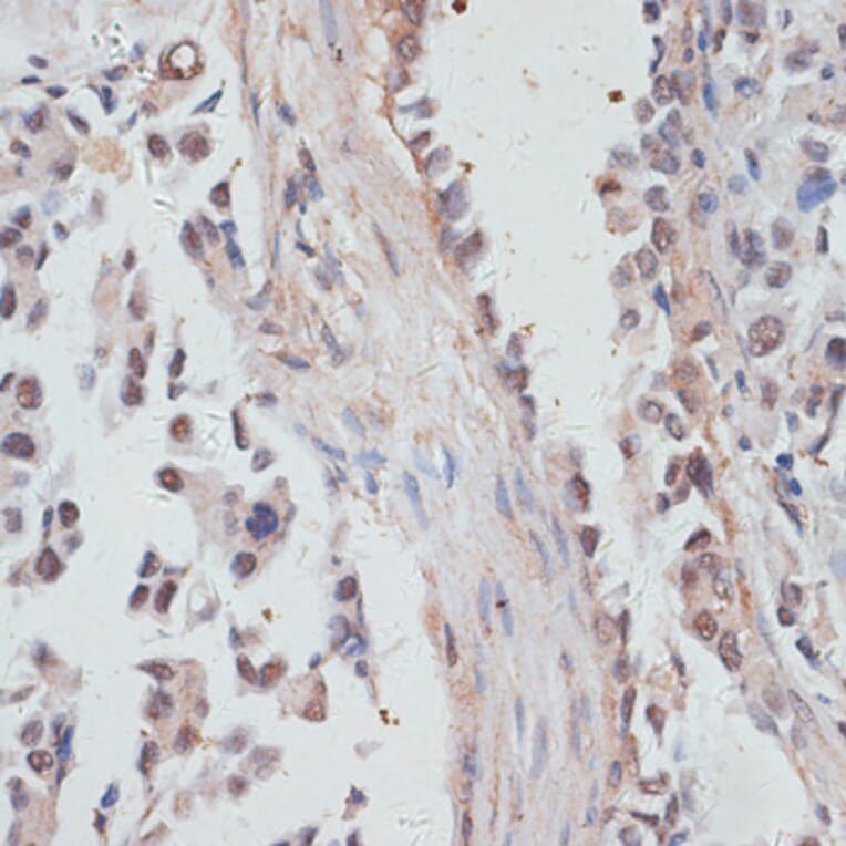 Immunohistochemistry - Anti-NCOA4 Antibody (A5695) - Antibodies.com