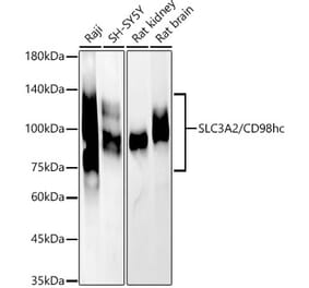 Western Blot - Anti-CD98 Antibody (A11865) - Antibodies.com