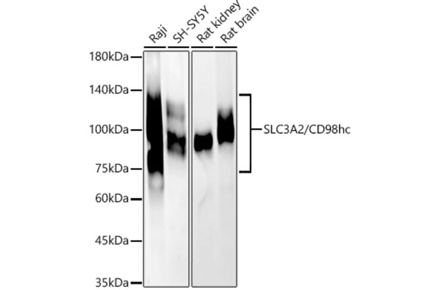 Western Blot - Anti-CD98 Antibody (A11865) - Antibodies.com