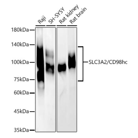 Western Blot - Anti-CD98 Antibody (A11865) - Antibodies.com
