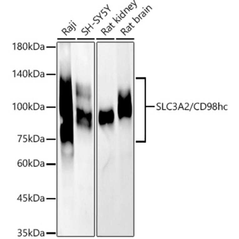 Western Blot - Anti-CD98 Antibody (A11865) - Antibodies.com