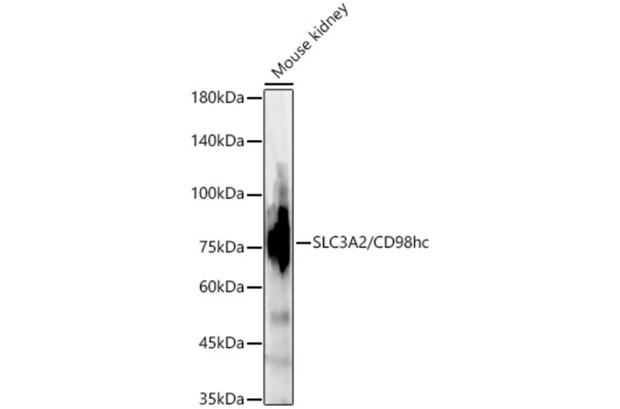 Western Blot - Anti-CD98 Antibody (A11865) - Antibodies.com