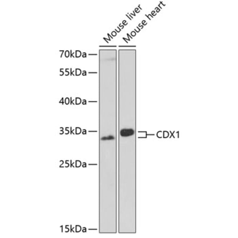 Western Blot - Anti-Cdx1 Antibody (A11866) - Antibodies.com