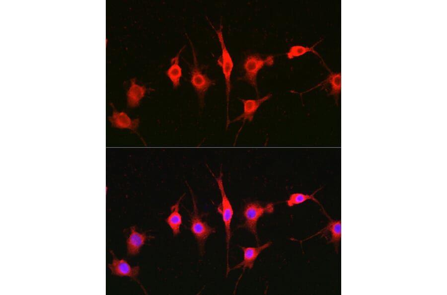 Immunofluorescence - Anti-Heparanase 1 Antibody (A11867) - Antibodies.com