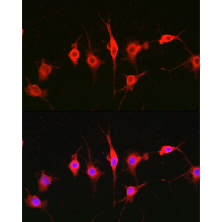Immunofluorescence - Anti-Heparanase 1 Antibody (A11867) - Antibodies.com
