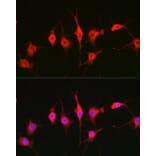 Immunofluorescence - Anti-Heparanase 1 Antibody (A11867) - Antibodies.com