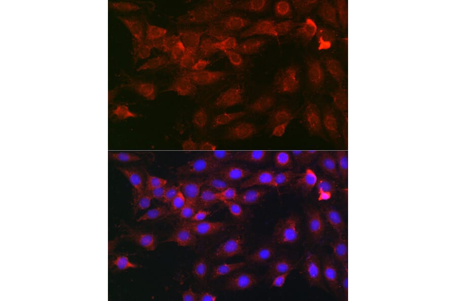 Immunofluorescence - Anti-Heparanase 1 Antibody (A11867) - Antibodies.com