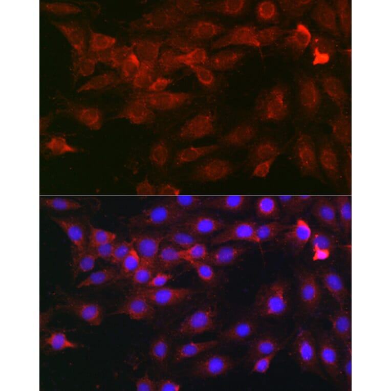 Immunofluorescence - Anti-Heparanase 1 Antibody (A11867) - Antibodies.com