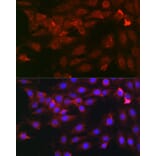 Immunofluorescence - Anti-Heparanase 1 Antibody (A11867) - Antibodies.com