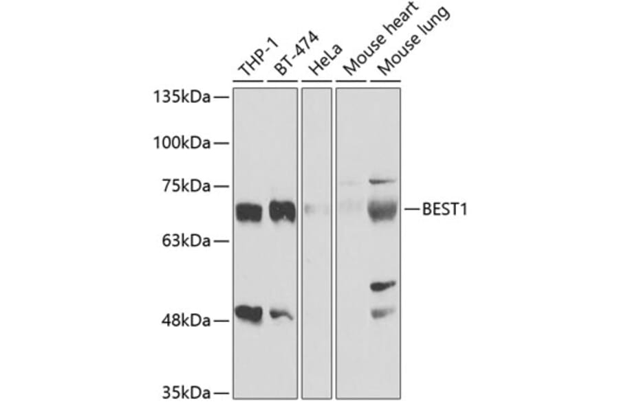 Western Blot - Anti-Bestrophin / BEST1 Antibody (A11868) - Antibodies.com