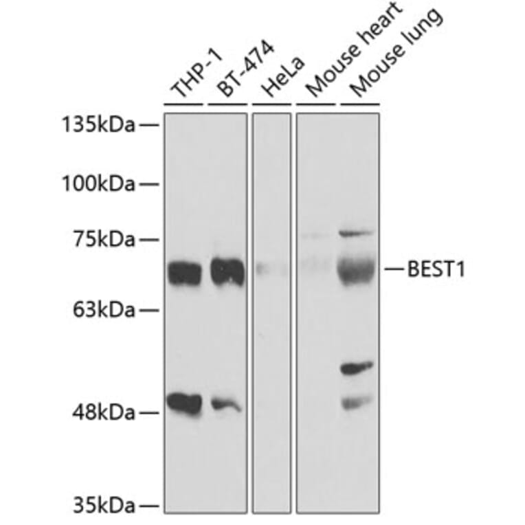 Western Blot - Anti-Bestrophin / BEST1 Antibody (A11868) - Antibodies.com