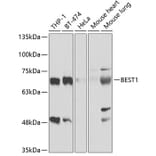 Western Blot - Anti-Bestrophin / BEST1 Antibody (A11868) - Antibodies.com