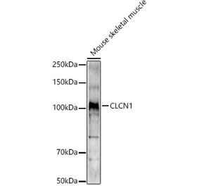 Western Blot - Anti-CLCN1 Antibody (A11870) - Antibodies.com