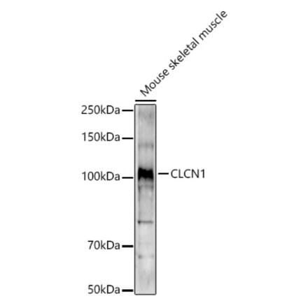 Western Blot - Anti-CLCN1 Antibody (A11870) - Antibodies.com