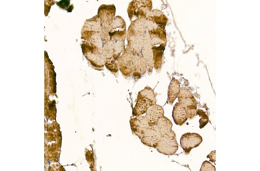 Immunohistochemistry - Anti-CLCN1 Antibody (A11870) - Antibodies.com