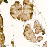 Immunohistochemistry - Anti-CLCN1 Antibody (A11870) - Antibodies.com