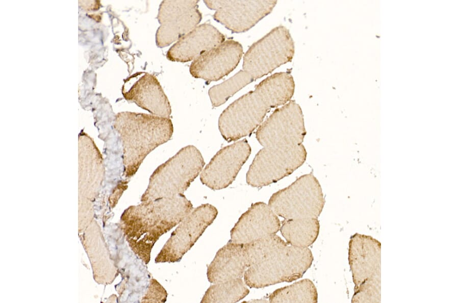 Immunohistochemistry - Anti-CLCN1 Antibody (A11870) - Antibodies.com