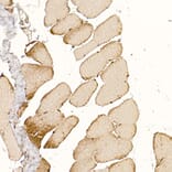 Immunohistochemistry - Anti-CLCN1 Antibody (A11870) - Antibodies.com