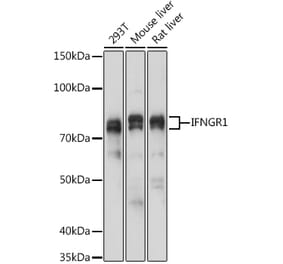 Western Blot - Anti-IFNGR1 Antibody (A11871) - Antibodies.com