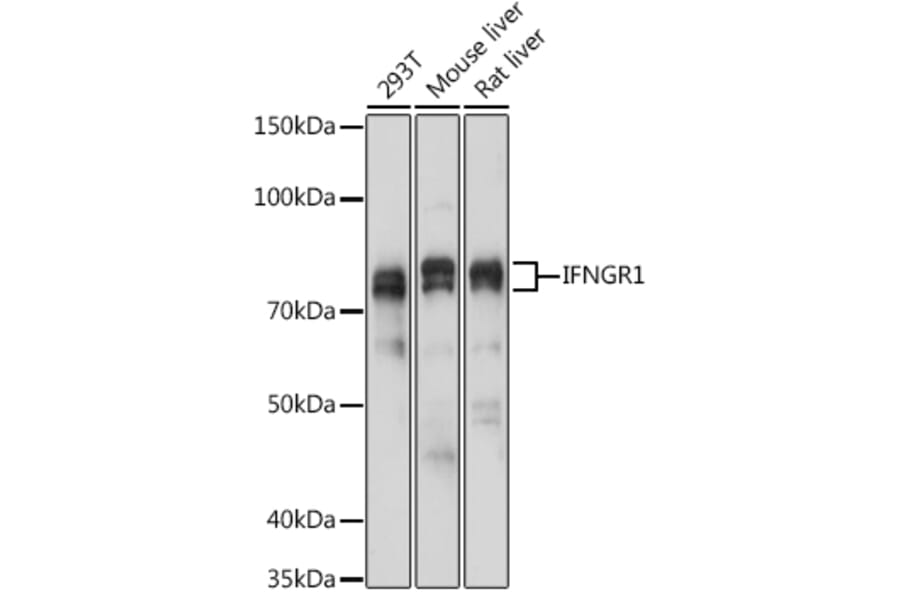 Western Blot - Anti-IFNGR1 Antibody (A11871) - Antibodies.com