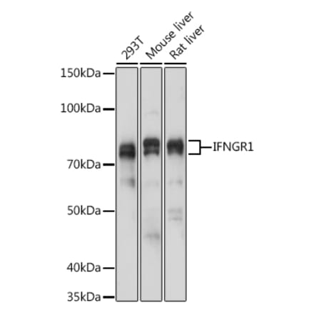 Western Blot - Anti-IFNGR1 Antibody (A11871) - Antibodies.com