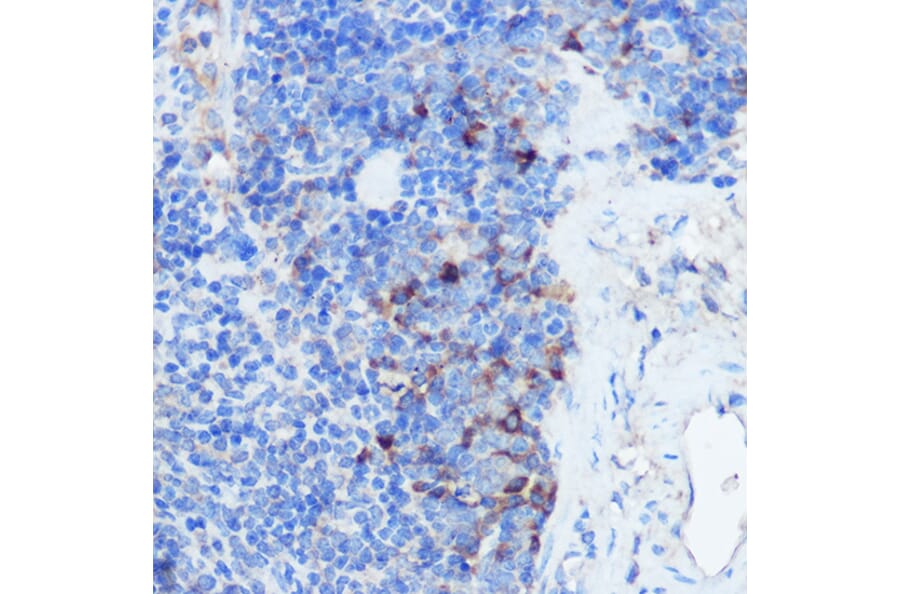 Immunohistochemistry - Anti-IFNGR1 Antibody (A11871) - Antibodies.com