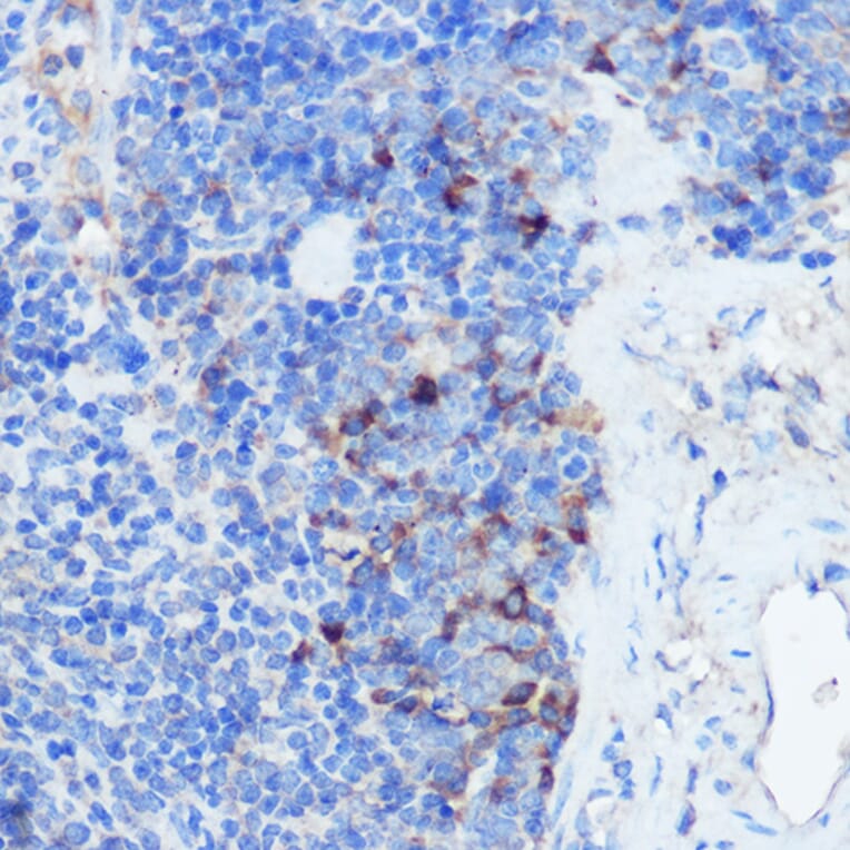 Immunohistochemistry - Anti-IFNGR1 Antibody (A11871) - Antibodies.com