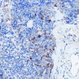 Immunohistochemistry - Anti-IFNGR1 Antibody (A11871) - Antibodies.com