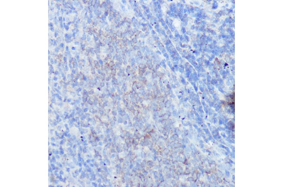 Immunohistochemistry - Anti-IFNGR1 Antibody (A11871) - Antibodies.com