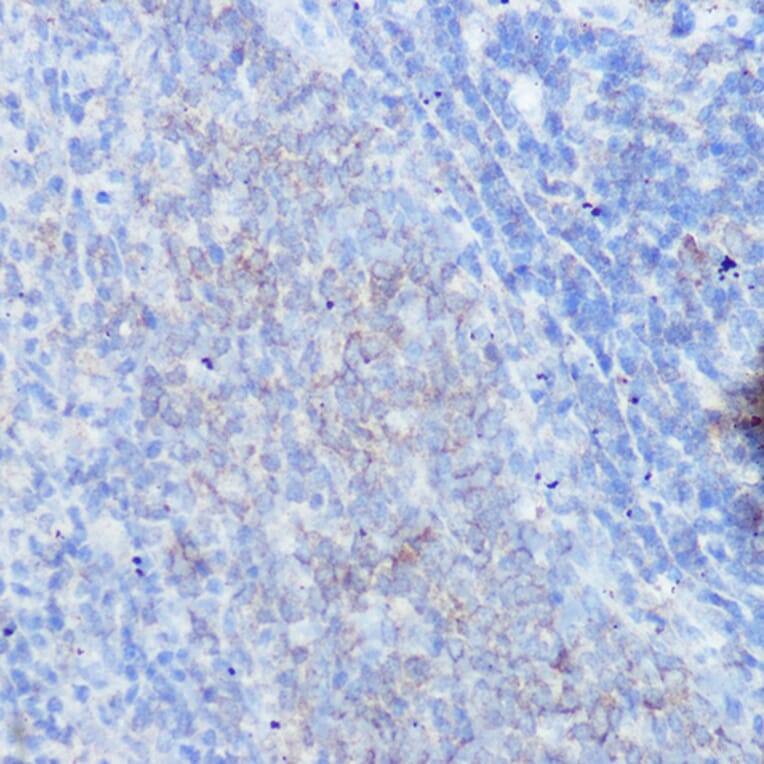 Immunohistochemistry - Anti-IFNGR1 Antibody (A11871) - Antibodies.com