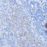 Immunohistochemistry - Anti-IFNGR1 Antibody (A11871) - Antibodies.com