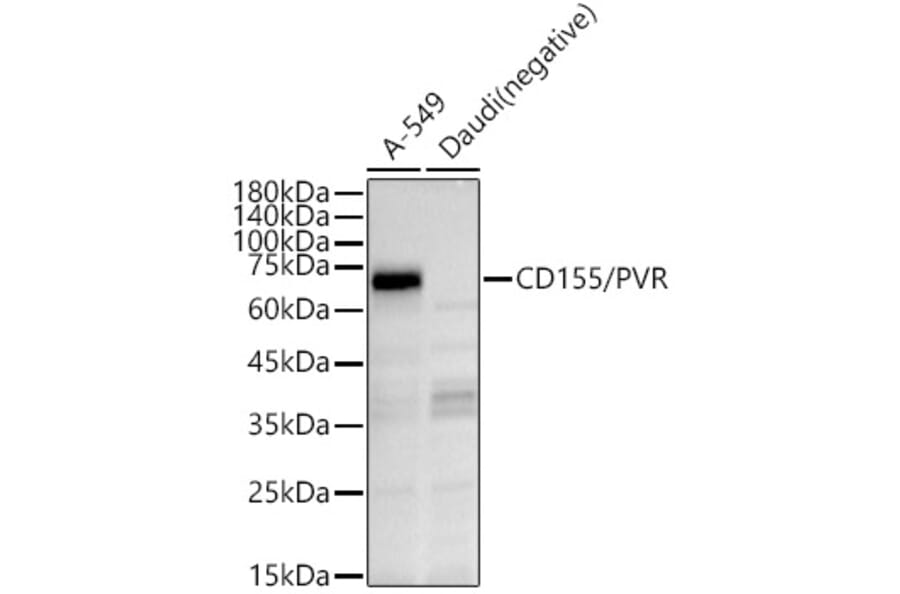 Western Blot - Anti-Poliovirus Receptor/PVR Antibody (A11872) - Antibodies.com