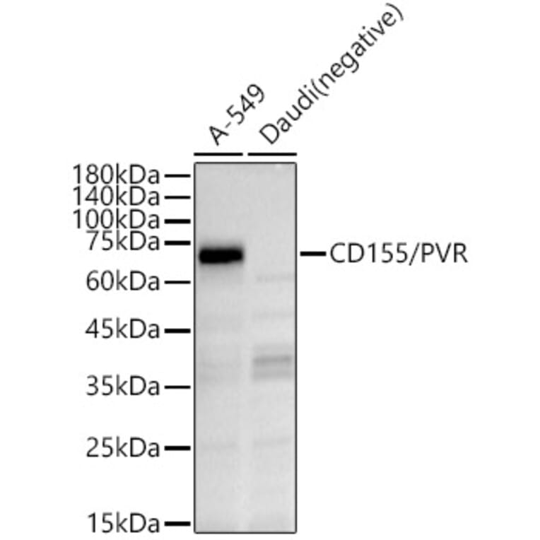 Western Blot - Anti-Poliovirus Receptor / PVR Antibody (A11872) - Antibodies.com