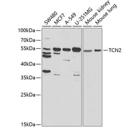 Western Blot - Anti-TC-2 Antibody (A11873) - Antibodies.com
