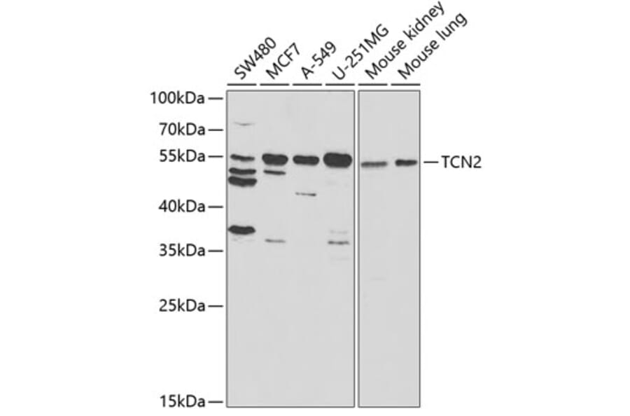 Western Blot - Anti-TC-2 Antibody (A11873) - Antibodies.com